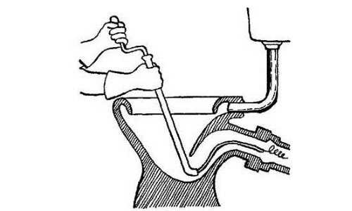 Как избавиться от засора в унитазе в домашних условиях – Как пробить унитаз подручными средствами в домашних условиях и не допустить его засора в дальнейшем (видео)