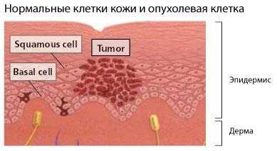 Ультрафиолетовый луч – Ультрафиолетовое излучение — Википедия